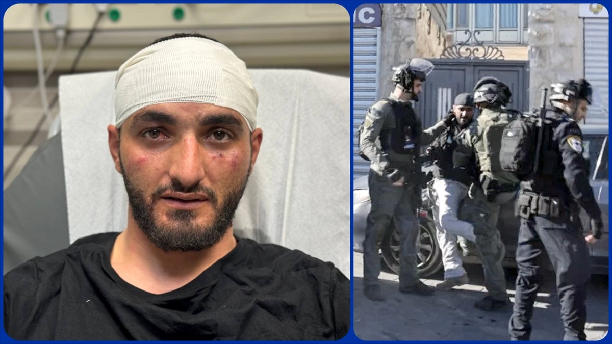 İsrail güçleri, AA foto muhabirini görevi sırasında şiddetle darbetti