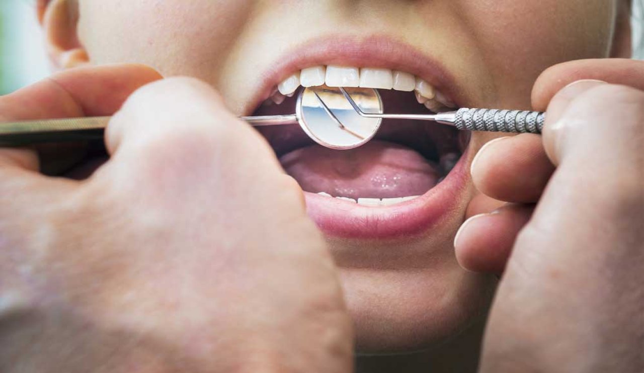 Diş çürüğü kabusu bitti: Biyoaktif malzemeler çocuk dişlerini kurtarıyor!
